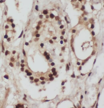 RPL3 Antibody
