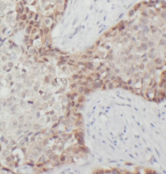 RPL37A Antibody