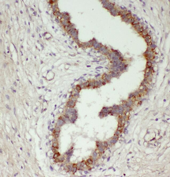 RPL7A Antibody