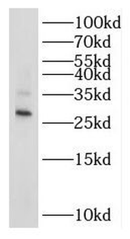 RPL7L1 Antibody