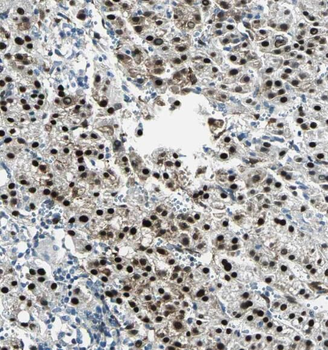 RPL7L1 Antibody