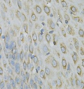 RPLP0 Antibody