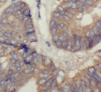RPLP0 Antibody