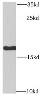 RPLP1 Antibody