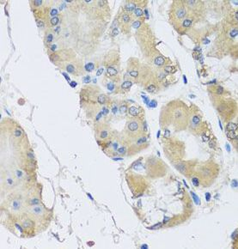 RPLP1 Antibody