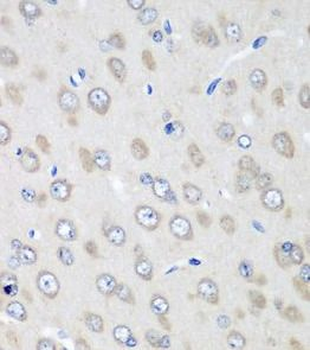 RPN2 Antibody