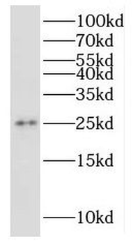 RPP25 Rabbit Polyclonal Antibody