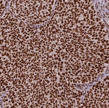 RPP25 Antibody