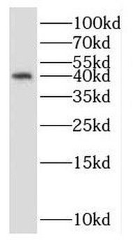 RPP40 Antibody