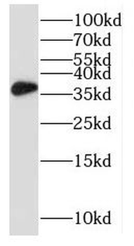 RPRD1B Antibody