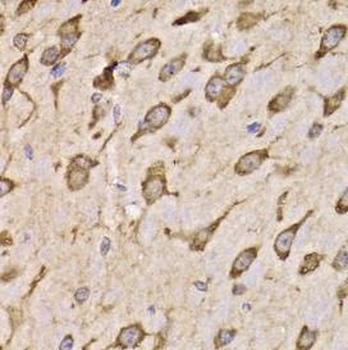 RPS14 Antibody