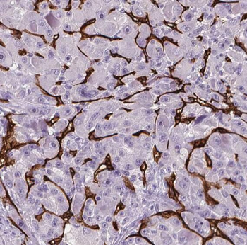 RPS15 Antibody