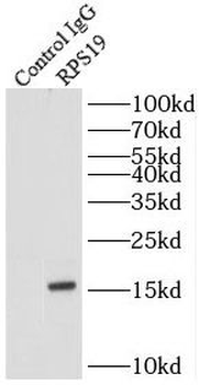 RPS19 Antibody