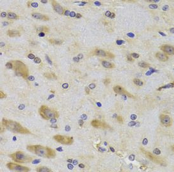 RPS27 Antibody