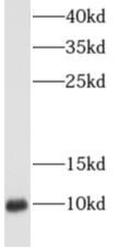 RPS27A Rabbit Polyclonal Antibody