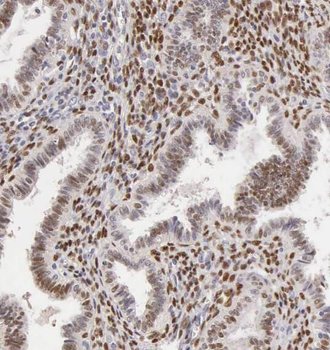 RPS27A Rabbit Polyclonal Antibody