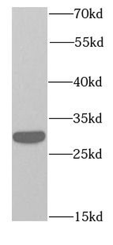 RPS3 Antibody