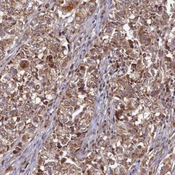 RPS3 Antibody