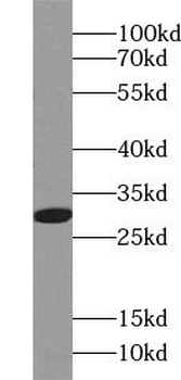 RPS4X Antibody