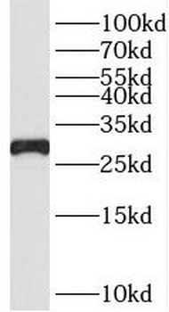 RPS4Y1 Antibody