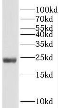 RPS5 Antibody