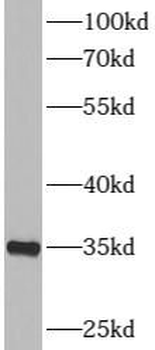 RPS6 Rabbit Polyclonal Antibody