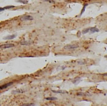 RPS6 Rabbit Polyclonal Antibody