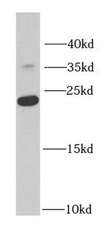 RPS7 Antibody