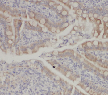 CNOT9 Antibody