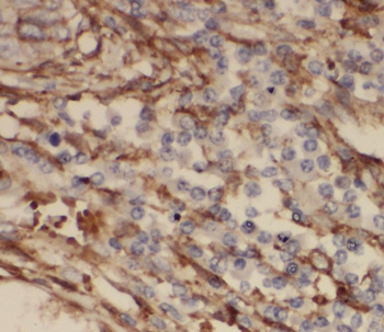 RRAS2 Antibody