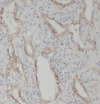 RRBP1 Antibody