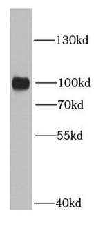 RRM1 Antibody
