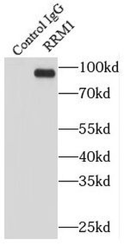 RRM1 Antibody