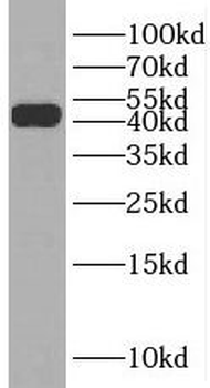 RRM2 Antibody