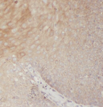 RRM2 Antibody
