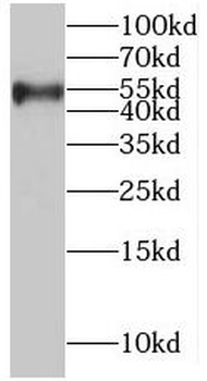 RRP1 Antibody