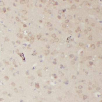 RRP7A Antibody