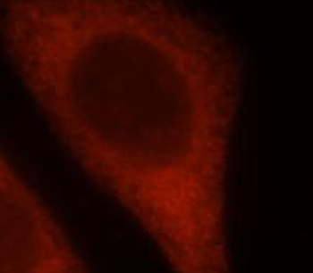 RSAD2 Antibody