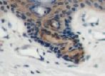 RSAD2 Antibody