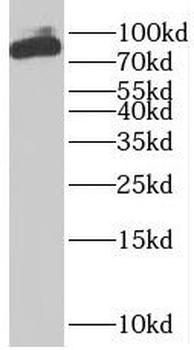 RPS6KA3 Antibody