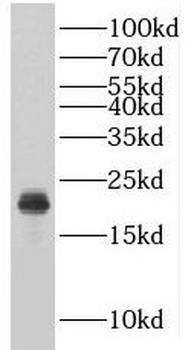 RSL24D1 Antibody