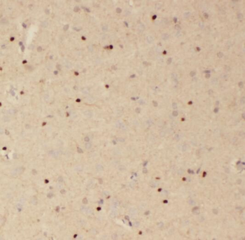 RSPH3 Antibody