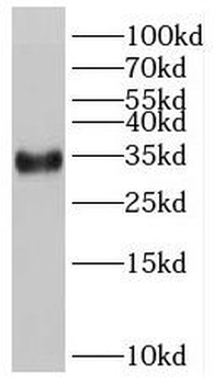 RSPO2 Antibody