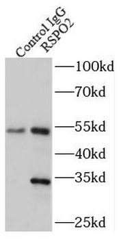 RSPO2 Antibody