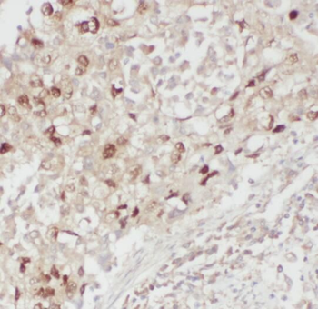 RSPO3 Antibody
