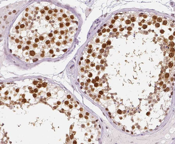 RTKN2 Antibody