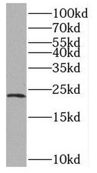RTN2 Rabbit Polyclonal Antibody