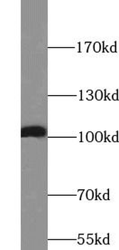 RTN3 Antibody