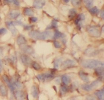 RTN3 Antibody