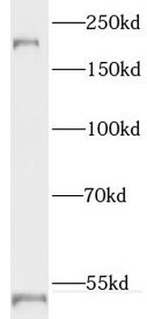 RTN4 Rabbit Polyclonal Antibody